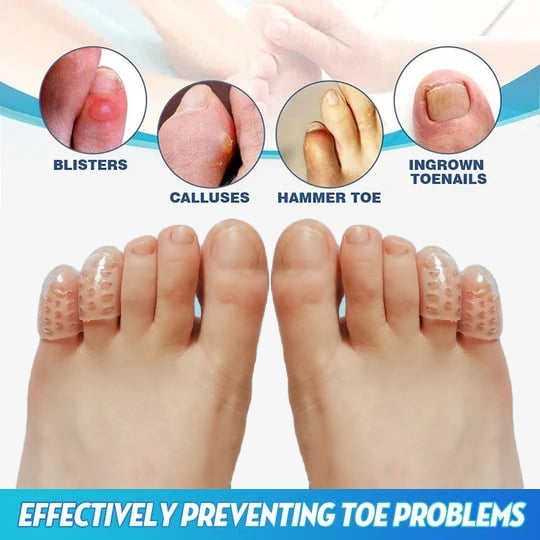 (🔥SUMMER HOT SALE🔥) Little Toe Protectors